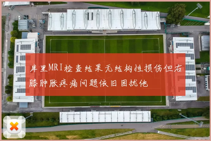 库里MRI检查结果无结构性损伤但右膝肿胀疼痛问题依旧困扰他